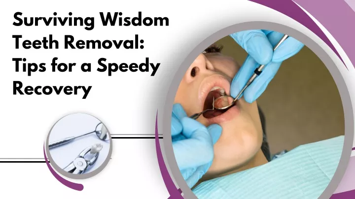 surviving wisdom teeth removal tips for a speedy