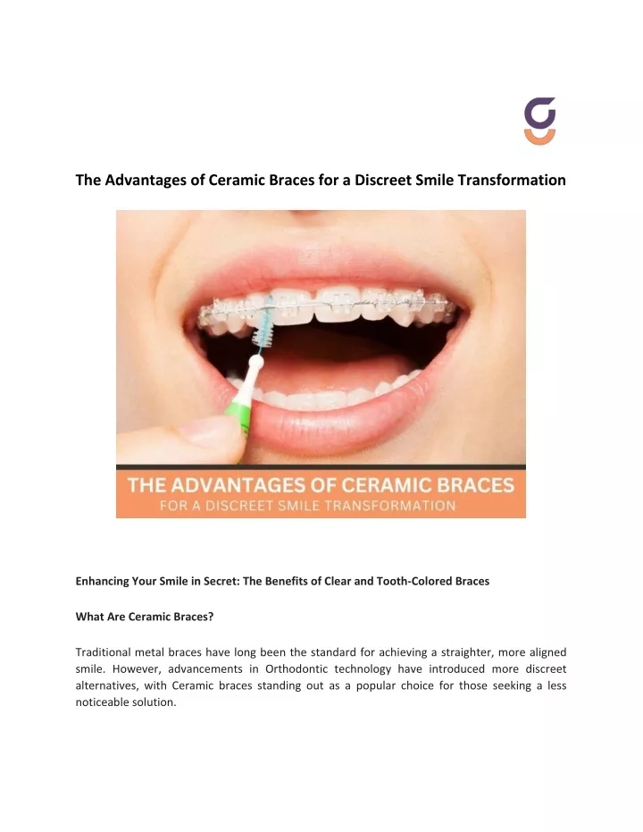 the advantages of ceramic braces for a discreet