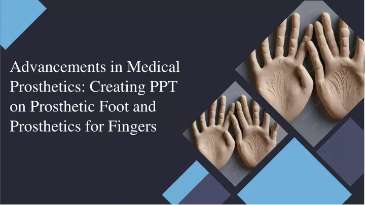 advancements in medical prosthetics creating ppt on prosthetic foot and prosthetics for fingers
