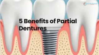 5 Benefits of Partial Dentures