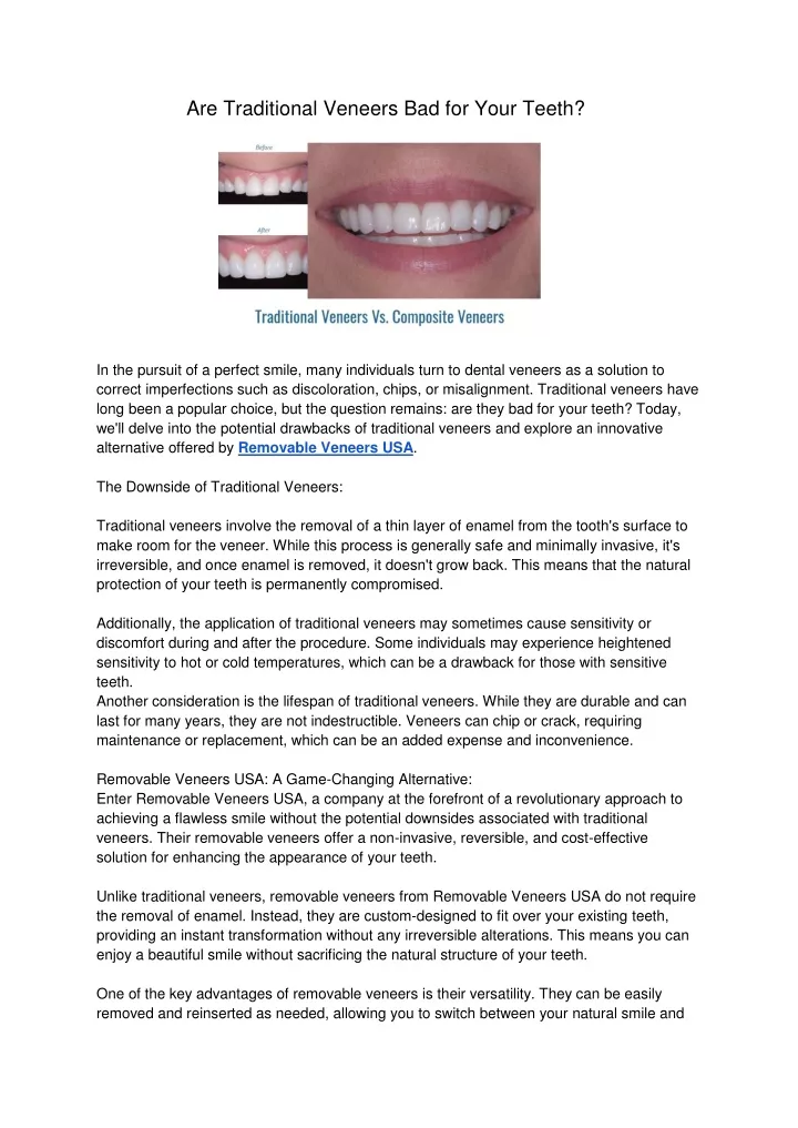 are traditional veneers bad for your teeth