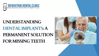 Understanding Dental Implants A Permanent Solution for Missing Teeth