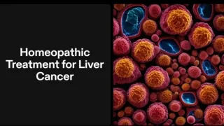 Homeopathic Treatment for Liver Cancer