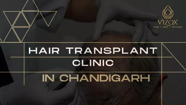 hair transplant clinic in chandigarh