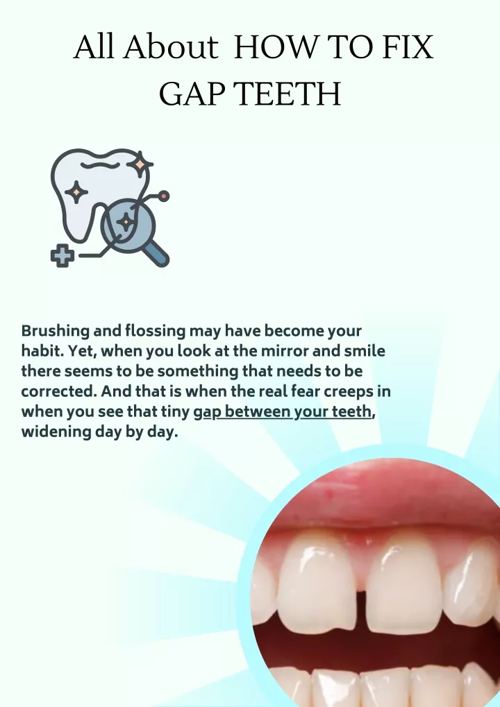 all about how to fix gap teeth