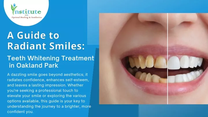 teeth whitening treatment in oakland park