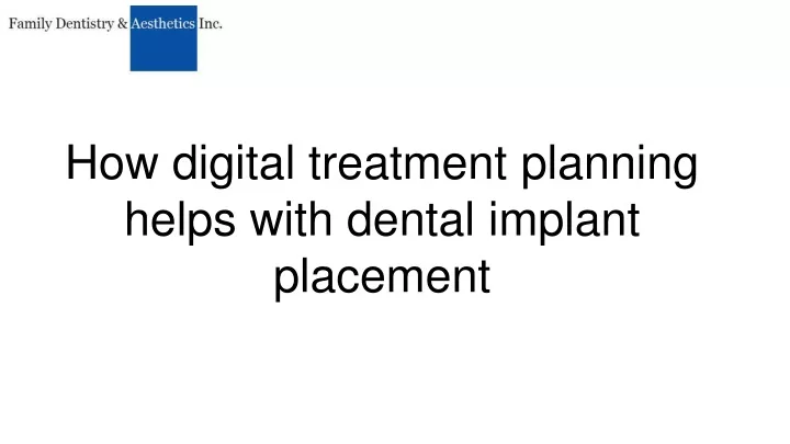 how digital treatment planning helps with dental implant placement