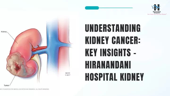 understanding kidney cancer key insights