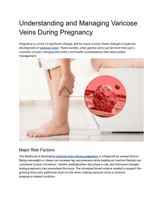 Understanding and Managing Varicose Veins During Pregnancy