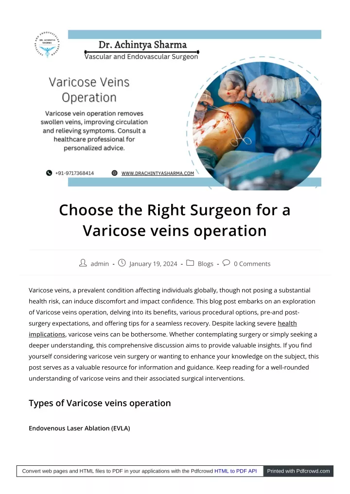 choose the right surgeon for a varicose veins