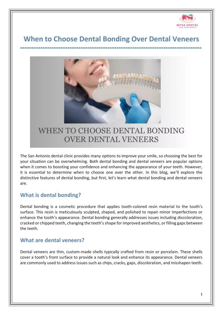 when to choose dental bonding over dental veneers