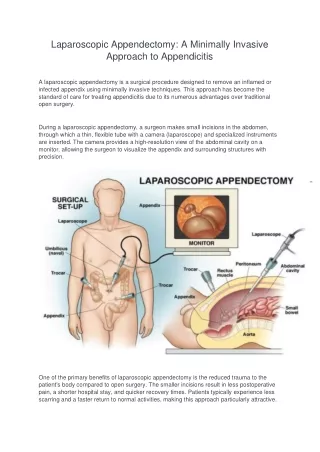 Laparoscopic Appendectomy: A Minimally Invasive Approach to Appendicitis