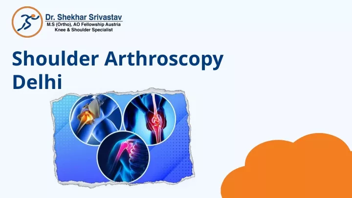shoulder arthroscopy delhi