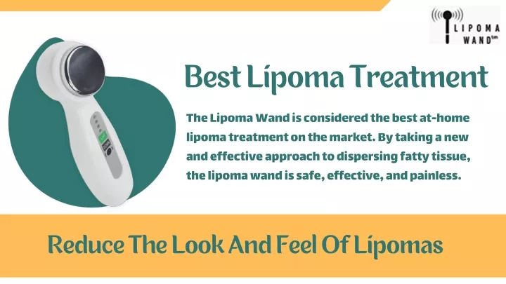 best lipoma treatment
