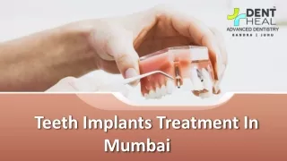 Dent Heal: Premier Teeth Implants Treatment in Mumbai for a Lasting Smile