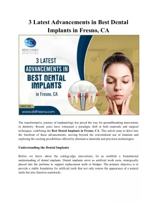 Best Dental Implants in Fresno and Latest Advancements