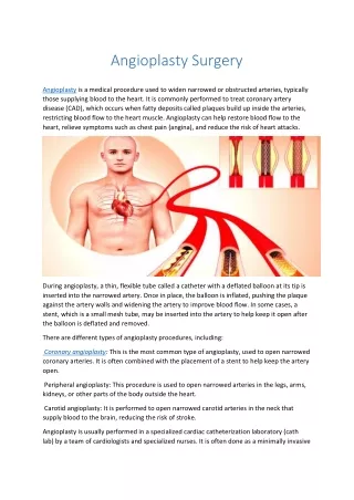 Angioplasty Surgery