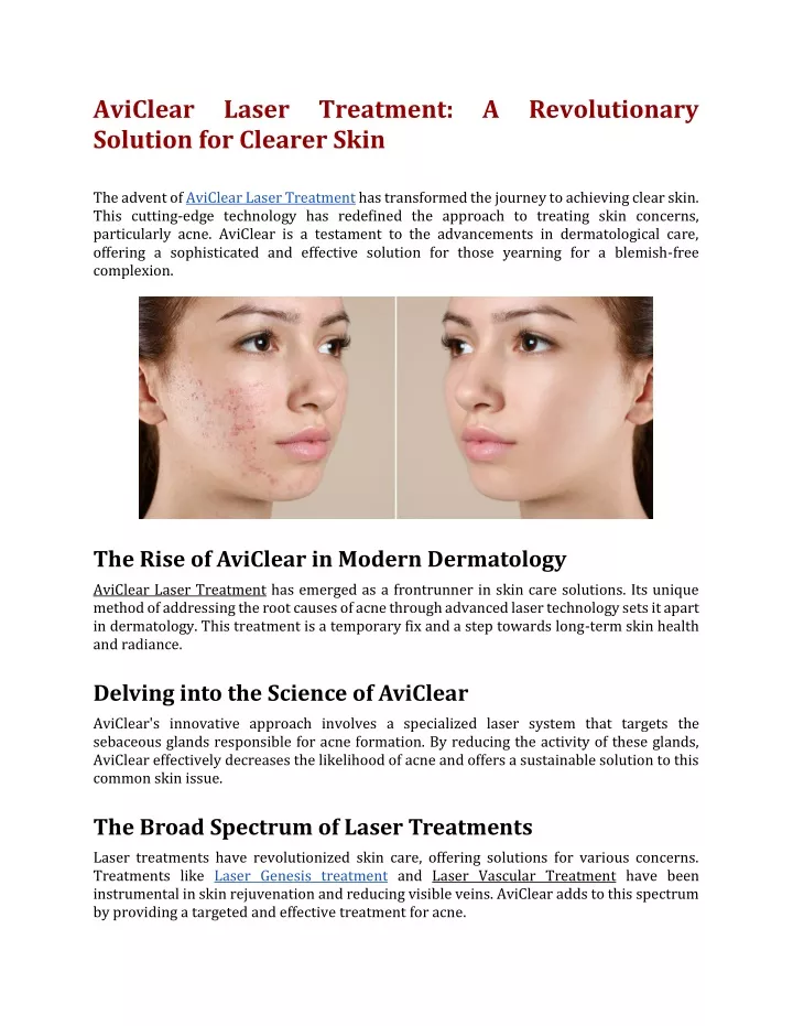 aviclear laser solution for clearer skin