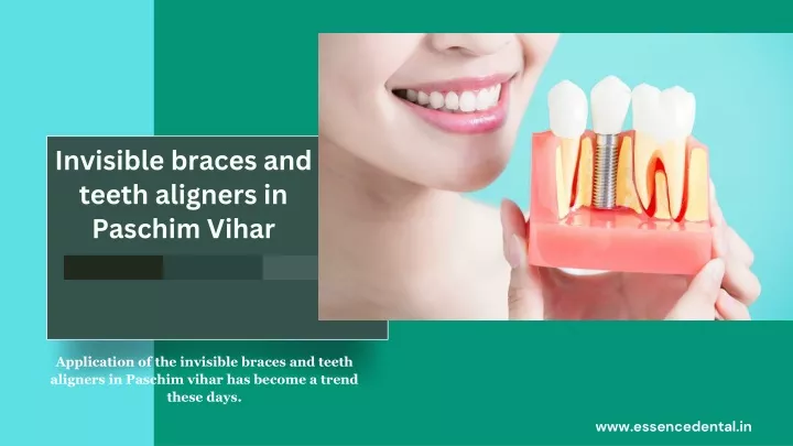 invisible braces and teeth aligners in paschim