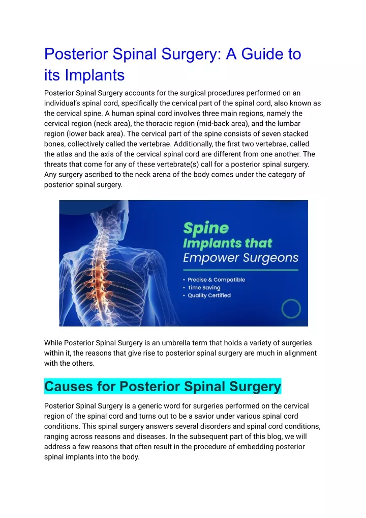 posterior spinal surgery a guide to its implants