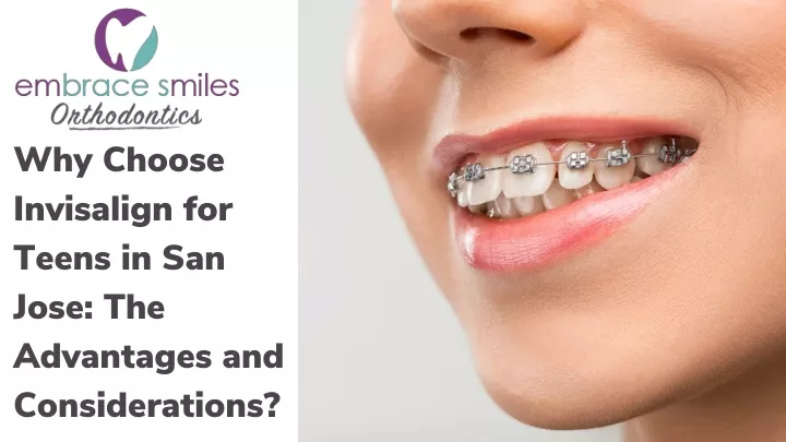 why choose invisalign for teens in san jose