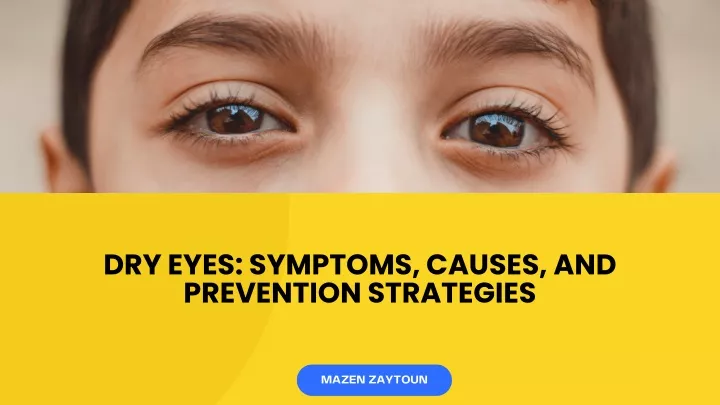 dry eyes symptoms causes and prevention strategies