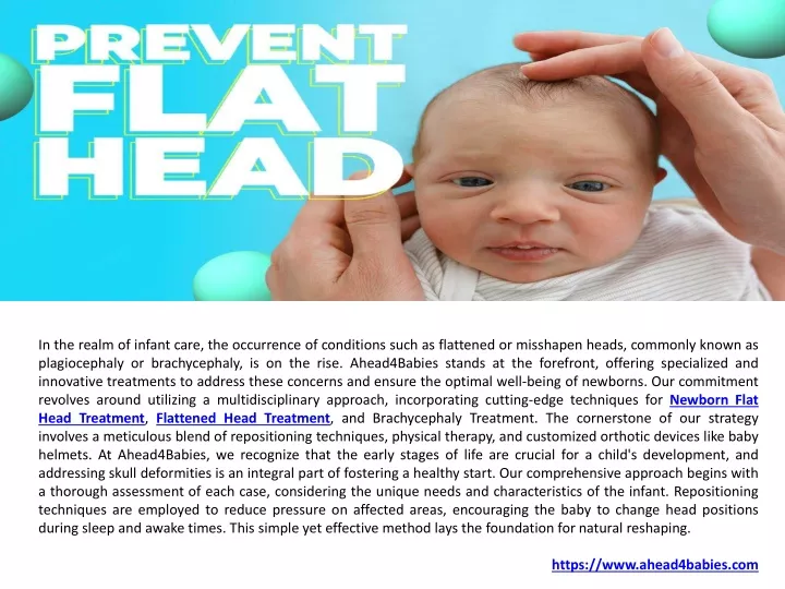 PPT - Plagiocephaly Helmet & Baby Head Shape Treatment UK PowerPoint ...