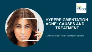 Acne Hyperpigmentation: Causes & Solutions