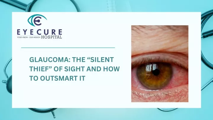 glaucoma the silent thief of sight