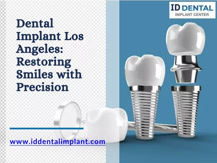 dental implant los angeles restoring smiles with