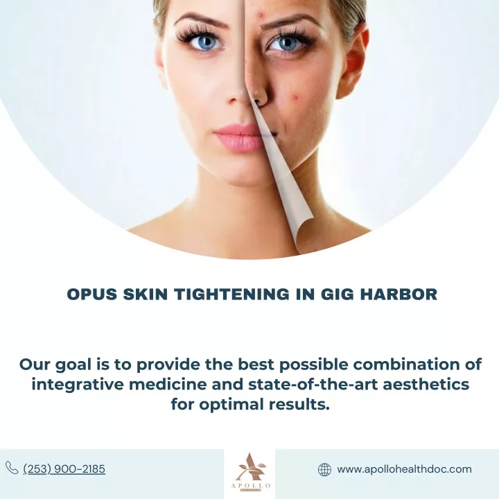 opus skin tightening in gig harbor