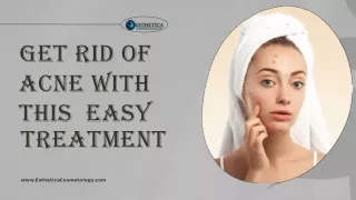 Get Rid Of Acne With This Easy Treatment