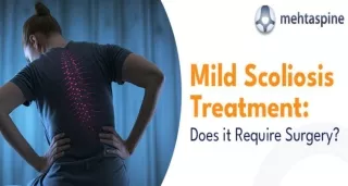 Mild Scoliosis Treatment: Does it Require Surgery? | Mr Jwalant S Mehta