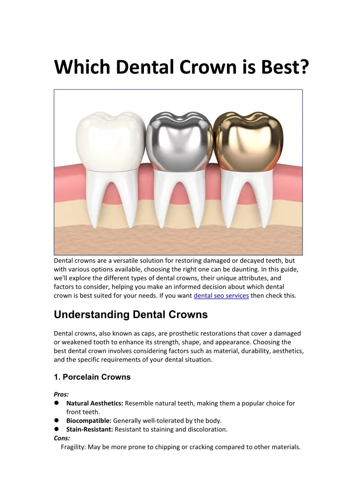 which dental crown is best