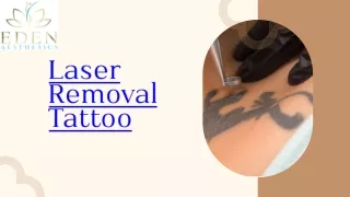 Laser Removal Tattoo | Eden Aesthetics Clinic