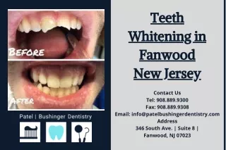 Teeth Whitening in Fanwood New Jersey