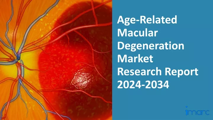 age related macular degeneration market research report 2024 2034