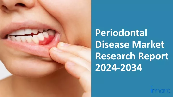 periodontal disease market research report 2024 2034