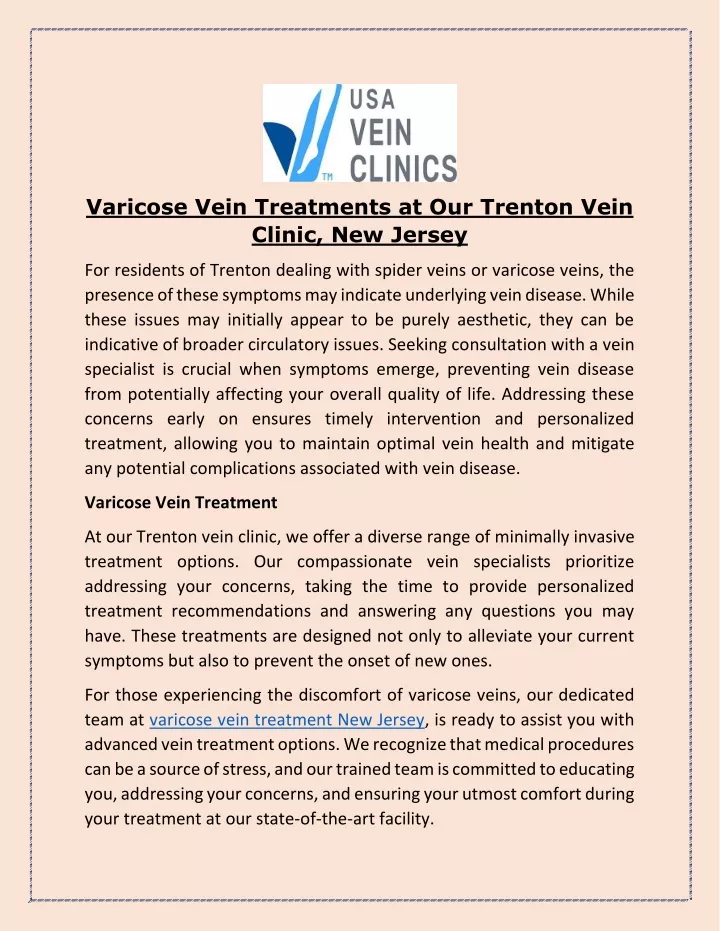 varicose vein treatments at our trenton vein