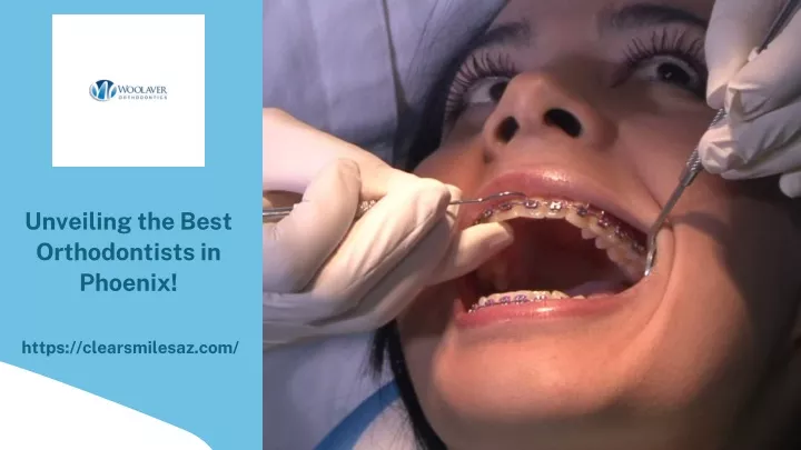 unveiling the best orthodontists in phoenix