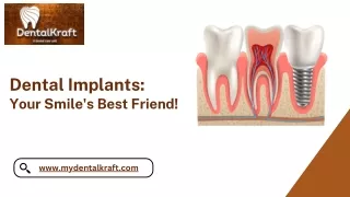 Best Dental Implant Doctor in Indirapuram