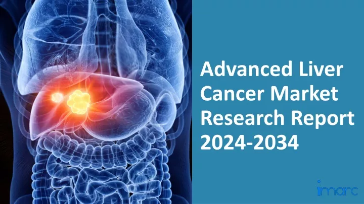 advanced liver cancer market research report 2024 2034