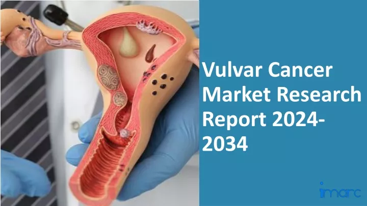 vulvar cancer market research report 2024 2034