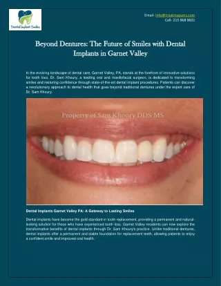 Beyond Dentures: The Future of Smiles with Dental Implants in Garnet Valley