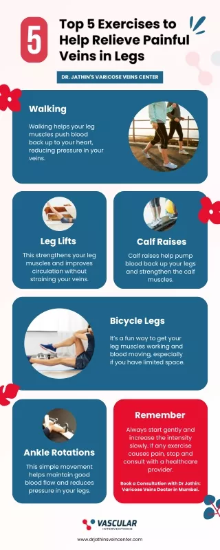 Top 5 Exercises to Help Relieve Painful Veins in Legs