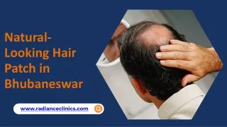 Natural-Looking Hair Patch in Bhubaneswar