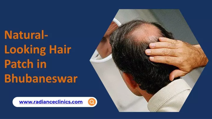 natural looking hair patch in bhubaneswar
