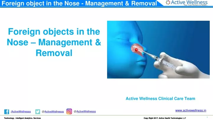 foreign object in the nose management removal