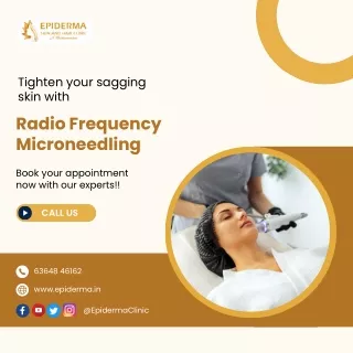 RF Microneedling | Best Dermatology Centre in Jayanagar | Epiderma Clinic