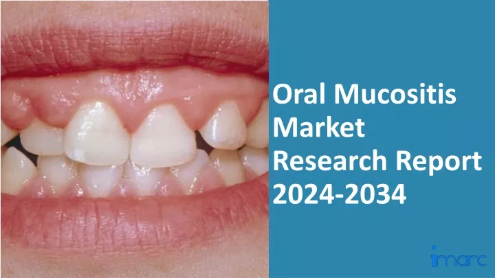 oral mucositis market research report 2024 2034
